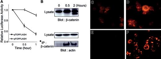 Fig. 7. Anti-Fas induces down-regulation of β-catenin–associated transcription and redistribution of β-catenin to cytoskeleton. / (A) Jurkat cells were transfected with 10 μg pTOPFLASH or pFOPFLASH, incubated for 18 hours, and further incubated for the time indicated in the presence of anti-Fas antibody (100 ng/mL). Cells were then lysed, and luciferase activity was assayed as described in “Materials and methods.” (B) Immunoblot analysis. Jurkat cells were incubated with anti-Fas (100 ng/mL) for the indicated times and extracted in CSK buffer, and β-catenin was immunoprecipitated with anti–β-catenin antibody directed to amino acids 571 to 781. Immunoprecipitates and total cell lysates were resolved by sodium dodecyl sulfate–polyacrylamide gel electrophoresis, transferred to nitrocellulose, and probed either with antibody to β-catenin or actin. (C-F) Immunocytochemical analysis. β-Catenin distribution was analyzed in a standard preparation (C,D) and in a cytoskeletal preparation (E,F), in which soluble proteins were removed by incubation in 1% Triton X-100. Control (C,E) and 30-minute anti-Fas–treated (D,F) Jurkat cells were stained with anti–β-catenin antibody C571-781 followed by Cy3-conjugated goat antimouse antibody. (Magnification, ×630).