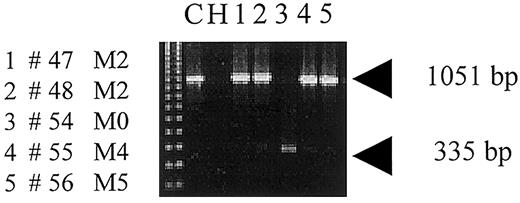 Fig. 6. Inability to detect exons 3, 4, and 5 from patient #54. / Shown is an ethidium-bromide–stained agarose gel demonstrating PCRs from cDNA of 5 AML patients amplifying the full-length wild-type sequence of PU.1 (1051 bp). In patient #54 (lane 3), only the splice variant involving exons 1 and 2 is detectable (335 bp). C indicates PU.1 wild-type plasmid serves as a positive control. H, water as a negative control.