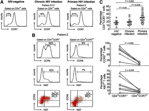Fig. 1. Distribution of chemokine receptors and of cycling capacity of CD4 T cells. / (A) Representative flow cytometry profiles of the distribution of CCR7 on gated CD4 T cells in HIV-negative and HIV-1–infected patients with chronic and primary infection. The individual data of the different cohorts analyzed are also shown. (B) Distribution of CCR5 and Ki67 on gated CD4+CCR7− and CD4+CCR7+ cells of a representative patient with primary HIV-1 infection. A large proportion of CD4+CCR7− cells expressed CCR5 and Ki67. The individual data of the different patients analyzed are also shown. Blood mononuclear cells were stained with anti-CD4 APC, anti-CCR5 CyChrome, anti-CCR7 PE, and anti-Ki67 FITC antibodies.
