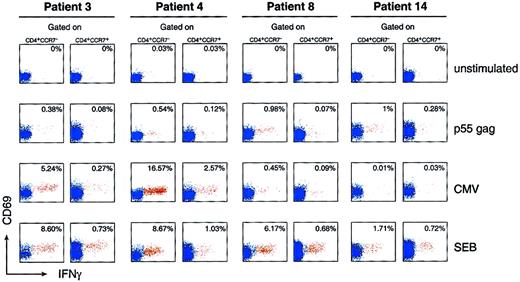 Fig. 2. Analysis of HIV-1– and CMV-specific CD4 T cells within different populations of memory cells defined by the expression of CCR7. / Patients 3 and 4 had primary HIV-1 and CMV coinfection, patient 8 had primary HIV-1 infection and chronic CMV infection, and patient 14 had only primary HIV-1 infection. Blood mononuclear cells were stimulated with p55 gag and CMV lysates and analyzed for the expression of CD4, CCR7, CD69, and IFN-γ (intracellular expression). The data show the expression of CD69 and IFN-γ within CD4+CCR7− and CD4+CCR7+ T-cell populations. Negative control: unstimulated blood mononuclear cells. Positive controls: blood mononuclear cells stimulated with staphylococcal enterotoxin B. The cluster of events shown in red corresponds to the responder CD4 T cells (ie, coexpressing CD69 and IFN-γ), whereas the cluster of events in blue corresponds to the nonresponder CD4 T cells. The data are expressed as the percentage of cells coexpressing CD69 and IFN-γ within CD4+CCR7− and CD4+CCR7+ T-cell populations. Following in vitro antigen-specific stimulation, blood mononuclear cells were stained with anti–IFN-γ APC, anti-CD69 FITC, anti-CCR7 PE, and anti-CD4 CyChrome.