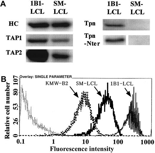 Fig. 1. Western blot and flow cytometric analysis of SM-LCL. / (A) Western blot analysis of SM-LCL. Cell lysates of 1B1-LCL (healthy control) and SM-LCL were put into reactions with antibodies as indicated. Tpn indicates tapasin; Tpn-Nter, tapasin molecules that were detected by the anti–N-terminal tapasin antibody, Rgp48N. In the Tpn-Nter lane, portions around 48 kd (normal tapasin) and 18 kd (putative truncated tapasin) were shown in 1B1-LCL and SM-LCL, respectively. (B) Flow cytometric analysis. Cell surface HLA class I expression was detected by monoclonal antibody FITC-w6/32. Cells were SM-LCL (Tpn-deficient), KMW-B2 (TAP1-deficient), and 1B1-LCL (healthy control). Thin dotted line indicates control FITC–immunoglobulin G.