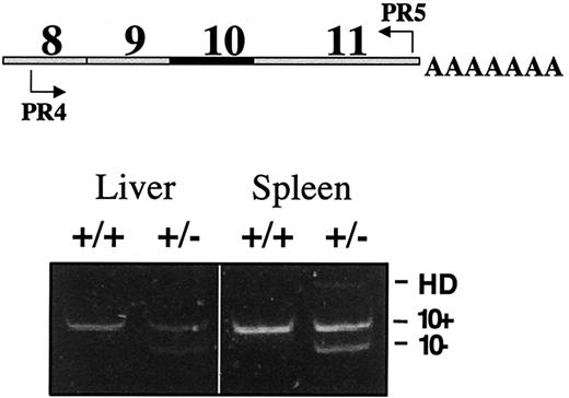 Fig. 2. RT-PCR analysis demonstrates equivalent levels of wild-type and exon 10 mRNA. / Levels of wild-type and mutant ferrochelatase mRNA in liver and spleen were determined using semiquantitative RT-PCR. Schematic indicates the location of the primers in the ferrochelatase cDNA used for RT-PCR analysis (top). Exon status of each PCR fragment is indicated (bottom). The slowest migrating band observed in the spleen +/− lane is a heteroduplex (HD) consisting of a wild-type DNA strand and an exon 10-deleted DNA strand. Genotypes of mice are indicated by +/+ (wild type) or +/− (heterozygous).