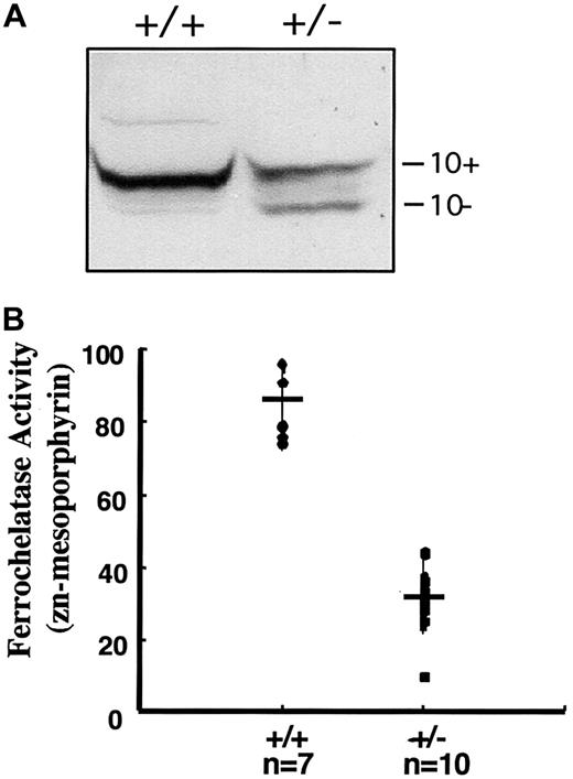 Fig. 3. Detection of an exon 10–ferrochelatase protein and decreased ferrochelatase activity heterozygous mice. / (A) Immunoblot analysis was used to determine ferrochelatase levels in liver mitochondrial extracts using an antirecombinant human ferrochelatase antibody that cross-reacts with mouse ferrochelatase. A 10% SDS-PAGE gel was used to separate the wild-type (+/+) ferrochelatase from the exon 10–deleted (+/−) ferrochelatase. (B) Liver mitochondrial ferrochelatase activities were determined by measuring the chelation rate of zinc and mesoporphyrin. The genotypes and number of mice represented in the graph are indicated below the x-axis. Average activities (cross-bars) and SEs (vertical lines) are indicated (SEM for +/+ = 9.6 and +/−= 8.8; P < .001). Units of activity are expressed as picomoles zinc-mesoporphyrin per milligram protein per hour.