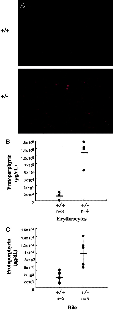 Fig. 4. Erythrocyte and bile protoporphyrin levels are elevated in heterozygous mice. / (A) Whole blood was isolated from tail vein of normal and heterozygous mice. Fluorescence of erythrocytes was detected by exciting an blood smear with 405-nm light. Images were captured with a Spot digital camera using an Olympus IX70, × 200 magnification. Genotypes are indicated to the left of the figures. (B) Erythrocyte and (C) bile protoporphyrin levels were determined by HPLC separation of pigments with subsequent spectrofluorometric analysis. The genotypes and number of mice represented in the data are indicated below the x-axis. Average activities (cross-bars) and SEs (vertical lines) are indicated. (SEM for free erythrocyte protoporphyrin +/+ = 1.8 × 104, +/−= 3.38 × 104; for bile, +/+ = 1.36 × 103, +/−= 3.14 × 103;P < .001).