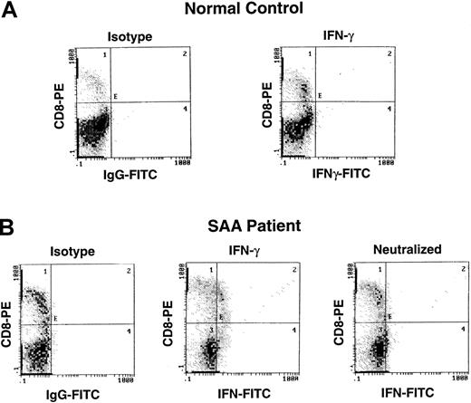 Fig. 2. Detection of IFN-γ by intracellular cytokine staining in patients with AA. / Lymphocytes from a patient with severe AA and a healthy control were surface stained with CD4-TC, and CD8-PE and intracellularly stained with mAb IFN-γ–FITC.