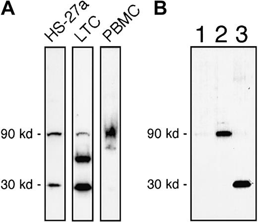 Fig. 3. Immunoblot analysis of IL-7R in HS-27a, LTCs, and PBMCs. / (A) Total protein extracts of HS-27a, LTCs, and PBMCs were analyzed for IL-7R by Western blot. The 30-kd form, which bound to the anti–IL-7R-IC antibodies, was detected in both HS-27a and primary stromal cell extracts (LTCs) but was almost absent in the PBMC extract. Comparable results were obtained from 4 different cell preparations. (B) Subcellular fractions (26 μg/lane) of HS-27a cells were analyzed by Western blot. Lane 1 represents the cytosol fraction; lane 2, the membrane fraction; and lane 3, the insoluble fraction. The full-length form of IL-7R (90 kd) was found in the membrane fraction, and the 30-kd form was exclusively found in the insoluble fraction of HS-27a cells. This is in keeping with the immunocytochemistry data that show staining localized to the nucleus.