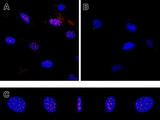 Fig. 4. Immunofluorescence localization of intracellular IL-7R. / HS-27a cells were fixed with methanol and incubated with the anti–IL7R-IC antibodies (A) or control immunoglobulins (B). The bound antibodies were detected with Cy5-conjugated secondary antibodies (red). Nuclei of the cells were counterstained with DAPI (blue), and 2-color fluorescence images were captured with a deconvolution fluorescence microscope. The images of a nucleus stained with the anti–IL7R-IC antibodies are reconstructed into a 3-dimensional image and rotated by 45° 4 times as shown in panel C. This clearly shows localization of the intracellular receptor in the nucleus. Original magnification × 400.