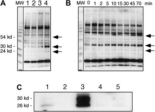 Fig. 6. Recombinant IL-7 enhanced tyrosine phosphorylation of proteins in HS-27a. / In panels A and B, tyrosine phosphorylated proteins were analyzed by immunoblots using an antiphosphotyrosine antibody. (A) HS-27a cells were cultured for 5 minutes in standard media (lane 1), or media containing 2 ng/mL IL-1β (lane 2), 10 ng/mL IL-7 (lane 3), or 100 ng/mL IL-7 (lane 4). (B) Cells were cultured in the presence of 100 ng/mL IL-7 for various times as shown. Arrows indicate positions of the tyrosine phosphorylated proteins, which increased after exposure to recombinant IL-7. MW shows a lane of molecular weight marker proteins. (C) Tyrosine-phosphorylated proteins were immunoprecipitated with the biotinylated recombinant RC20 antiphosphotyrosine antibody and immunoblotted with the anti–IL7R-IC antibodies. Cells were cultured in the presence (lanes 3 and 4) or absence (lanes 1 and 2) of 100 ng/mL IL-7 for 1 hour. Total proteins of the cells were extracted under denaturing conditions and immunoprecipitated with (lanes 1 and 3) or without (lanes 2 and4) the RC20 antibody. Mock immunoprecipitation was conducted with the RC20 antibody but without cellular extracts (lane 5).