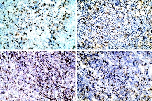 Fig. 2. Immunohistology of the T9-C2 injection site in a subcutaneous site. / Five million T9-C2 cells were injected in a subcutaneous site for 20 hours. The T9-C2 cells were excised and frozen sections were prepared. (A) Cells stained for granulocytes; (B) cells stained for iNOS; (C) cells stained with antinitrotyrosine; (D) cells stained for anti–HSP-70. All micrograms are × 200.