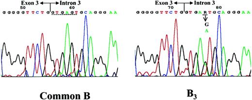 Fig. 1. Sequencing results of the exon 3–intron 3 junction of the ABO genes of a common group B individual and the B3 propositus. / Genomic DNAs were purified from an individual with common group B phenotype and an individual with B3 phenotype. The regions from exon 2 to intron 3 of the ABO genes were amplified by PCR, and the sequences were analyzed by direct sequencing. The sequencing results of the exon 3–intron 3 junctions of the common group B (left panel) and the B3 (right panel) samples are shown. In the B3 sample, a heterozygous state for G and A nucleotides (underlined) at the +5 position of intron 3 was demonstrated. A dashed line indicates the conserved sequence of the splice donor site.