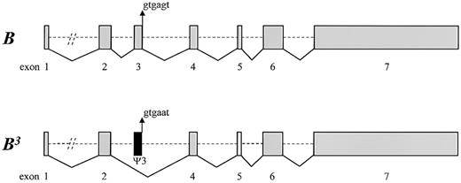 Fig. 4. Diagrammatic representation of the molecular basis for the B3 allele with the IVS3 + 5G → A splice site mutation. / The IVS3 + 5G → A mutation of the B3allele changes the consensus sequence of the splice donor site and causes the removal of exon 3 during the mRNA splicing processes, making the exon a pseudoexon. The dashed lines represent the intron regions, and the solid lines illustrate the linkages of exons during mRNA processing.