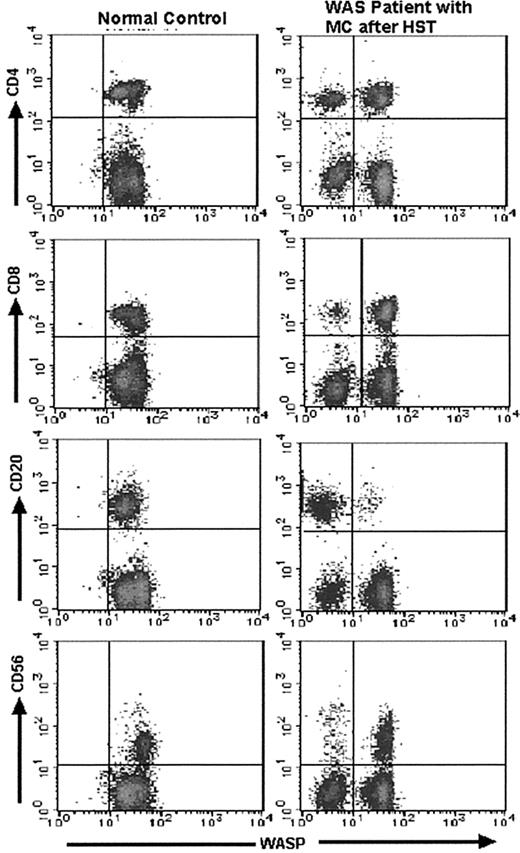 Fig. 2. Results of 2-color FCM-WASP. / Density plots are from 2-color FCM-WASP using CD4, CD8, CD20, and CD56 antibodies. All cells in the lymphocyte gate were analyzed. The x-axis represents WASP intensity; the y-axis represents the intensity of the respective CD marker. Shown are the results for patient 3 on day 720 after HST.