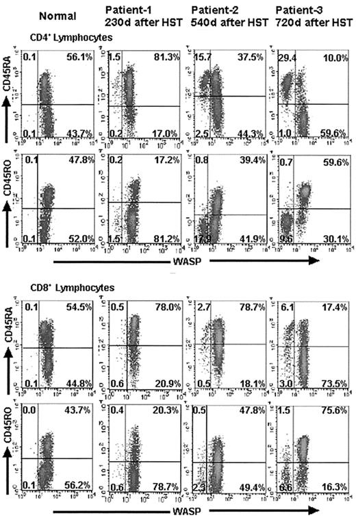 Fig. 5. Evaluation of the naive and memory profile of T cells in WAS patients after HST. / Density plots from 2-color immunofluorescence depict the results of 3-color FCM-WASP using anti-CD45RA or anti-CD45RO for each population of CD4+ and CD8+ T cells. All cells pictured were gated with a forward- and side-scatter lymphocyte gate combined with a CD4+ or CD8+ gate. The x-axis represents WASP staining intensity; the y-axis represents CD45RA or CD45RO expression. Numbers within the density plots represent the percentage of cells in each quadrant. It is noteworthy that in contrast to the WASPbright donor CD4+ and CD8+cells, most WASPdim recipient cells in patients 1, 2, and 3 remained CD45RA+/CD45RO− (naı̈ve) at the indicated days after HST.