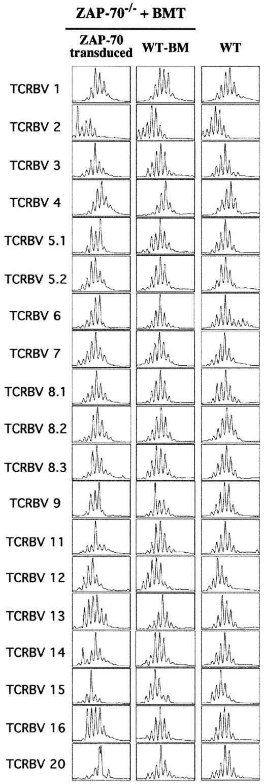 Fig. 4. Diverse T-cell repertoire following gene therapy of ZAP-70−/− mice. / The TCRBV repertoire was assessed by a comparison of TCR CDR3 size distribution (Immunoscope profiles) of splenocytes obtained from WT mice and ZAP-70−/− mice undergoing transplantation with either ZAP-70–transduced progenitor cells or WT BM. Twenty-four PCR products were generated by reverse transcription with 24 different TCRBV subfamily-specific primers and 1 constant β consensus primer (Cβ), followed by a runoff reaction with a fluorescent Cβ primer. The graphs represent fluorescence intensity in arbitrary units (y-axis) plotted against CDR3 size (x-axis). The size distributions within 19 TCRBV families from 1 of 4 analyzed mice in each of the 3 groups are shown.