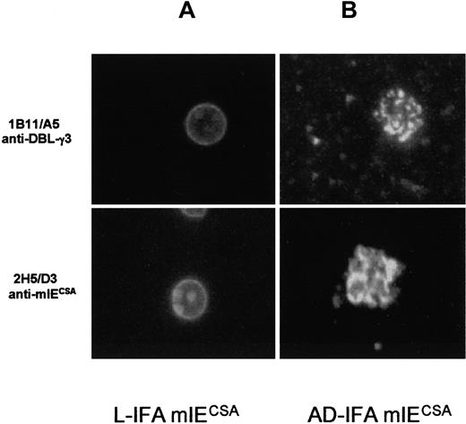 Fig. 2. Surface staining by L-IFA and AD-IFA. / Surface staining of live FCR3 mIECSA by L-IFA with 10 μg/mL anti-mIECSA mAb 2H5/D3 and 10 μg/mL anti–DBL-γ3 mAb 1B11/A5 (A). Staining by AD-IFA of the parasitophorous vacuole and vesiclelike structures in mIECSA with 10 μg/mL anti-mIECSA mAb 2H5/D3 and anti–DBL-γ3 mAb 1B11/A5 (B).