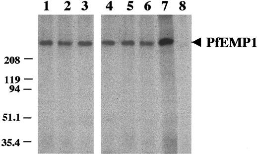 Fig. 3. Immunoprecipitation of PfEMP1CSA from surface 125I-labeled FCR3-mIECSA extract. / Lanes 1, 2, and 3: anti-mIECSA mAbs 2H5/D3, 2A11/B7, and 2A2/G6. Lanes 4, 5, and 6: anti–DBL-γ3 mAbs 1B11/A5, 4F10/G9, and 1B4/G10. Lane 7 positive control: pool of sera from multigravidae from Cameroon. Lane 8: unrelated IgM.