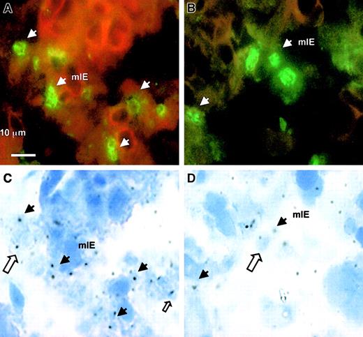 Fig. 4. Reactivity of mAbs 2H5/D3 and 1B11/A5 with placental parasites using tissue cryosections of a placenta from West African women. / Positive IF staining of sequestered mIE (plain arrow) with 10 μg/mL anti-mIECSA mAb (A) and with 10 μg/mL anti–DBL-γ3 mAb 1B11/A5 (B). Panels C and D show the corresponding placental cryosections under standard light transmission microscopy. A plain arrow shows the mIE corresponding to the IF-stained mIE in the upper part of the figure. Open arrows show that some of the mIEs are not recognized by these mAbs.