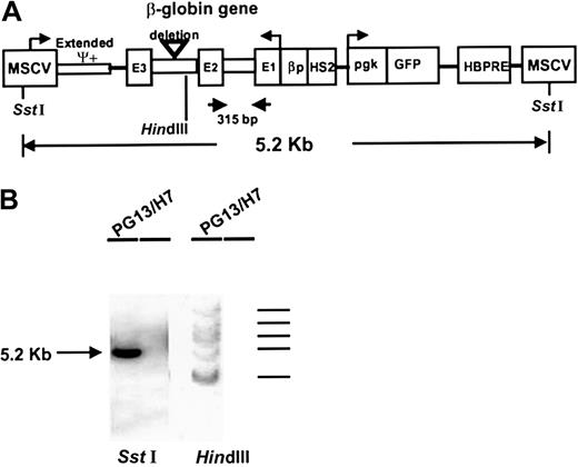 Fig. 1. Schematic representation of the MSCV-HS2-β-globin-GFP retroviral vector and its integration into PG13 producer cells (clone H7). / Panel A shows the different parts of the vector,6 which consists of a 5.2-kb fragment flanked with 2 LTRs derived from the MSCV, a human β-globin cassette containing the HS2 domain, the β-globin promoter (βp), and the genomic β-globin gene (3 exons, 2 introns) in reverse orientation. The vector also contains a humanized EGFP gene under the control of a phosphoglycerate kinase (pgk) promoter. A hepatitis B virus posttranscriptional regulatory element (HBPRE) has been inserted to enhance RNA transport from the nucleus. The arrows show the location of the β-globin sequence to which specific primers were made and the 315-bp fragment amplified by RT-PCR for detection of transgene-derived transcripts. ψ indicates the site of the extended packaging signal. Panel B shows a Southern blot ofSstI-digested DNA (left) and HindIII-digested DNA from the PG13 producer cell clone (H7) probed with a GFP probe. TheSstI blot shows a single band corresponding to the expected full-length vector. The HindIII blot indicates that 5 copies of the vector had been integrated into these producer cells.