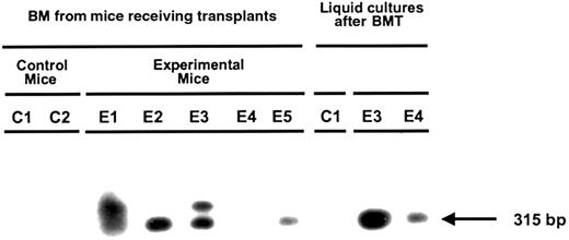 Fig. 7. Expression of the MSCV-HS2-β-globin-GFP vector human β-globin transgene in the erythroid progeny of transduced human fetal liver cells. / RNA was extracted from cells harvested from the marrow of mice engrafted with transduced human fetal liver cells (E1-5) and control mice engrafted with mock-transduced human fetal liver cells (C1,2) and from 3-week cultures of human erythroid cells derived from these mice. The presence of transgene-specific β-globin messenger RNA was assessed by RT-PCR using primers that amplify the mutant sequence of the β-globin transgene (Figure 1) not present in the normal human β-globin gene.