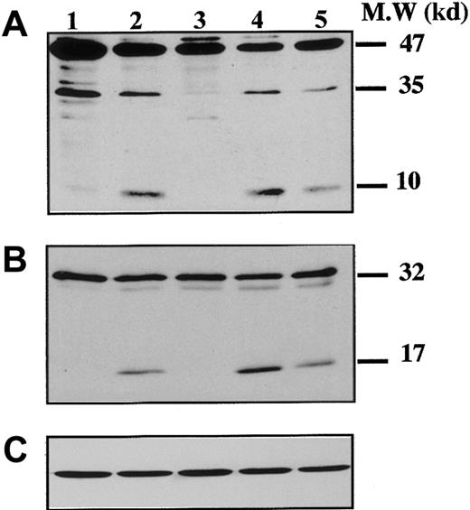 Fig. 3. Kinetics of caspase cleavage during MK differentiation. / Bone marrow CD34+ cells were cultured as in Figure 1. Western blot analyses were performed with anti–human caspase-9 (A) and anti–human caspase-3 (B) Abs. Equal loading was checked by stripping the membranes and reprobing with antiactin mAb (C). Positions of molecular mass markers are indicated at the right. Note that the 10-kd subunit of caspase-9 and the 17-kd active subunit of caspase-3 are not found in MKs lysed at day 8 (lane 1), detected when MKs are shedding platelets at day 12 of culture (lane 2). This cleavage is inhibited by z-VAD.fmk (lane 3), is increased by STS treatment (lane 4), and is also found later in culture, at day 13 (lane 5). Experiments were repeated twice and yielded similar results.