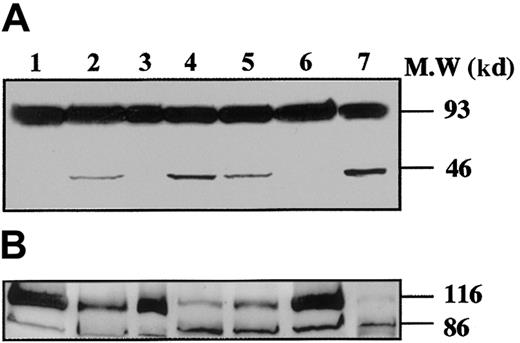 Fig. 4. Time-course of gelsolin and PARP processing during MK differentiation. / CD34+ cells were cultured during 6 days (lane 1), 11 days (lanes 2-4), and 13 days (lanes 5-7), in the presence of TPO only (lanes 1, 2, 5), TPO and Z-VAD.fmk from day 8 to day 11 (lanes 3 and 6) or TPO and STS during the last 12 hours (lanes 4 and 7). Cells were lysed and analyzed by immunoblotting with antigelsolin mAb (A) or anti-PARP antibody (B). Full-length gelsolin (A) and PARP (B) (migrating at 93 kd and 116 kd, respectively) and their cleavage products (46 kd and 86 kd, respectively) are indicated. The cleaved subunit was not detected when cells were cultured for 6 days in the presence of TPO (lane 1) and was present in mature MKs (lanes 2 and 5). This process is completely reverted by the inhibitor z-VAD.fmk (lanes 3 and 6), and the cleaved form is increased after STS treatment (lanes 4 and 7).