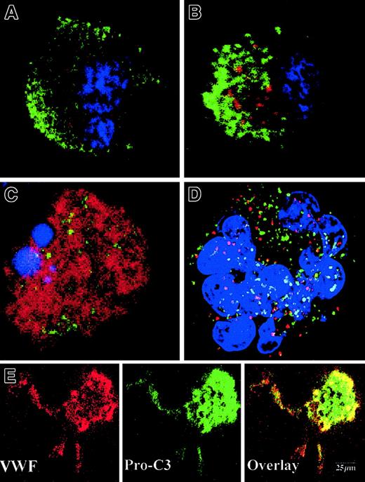 Fig. 5. Activated caspases are localized in the cytoplasm of maturing MKs. / Mobilized blood CD34+ cells were cultured as in Figure 1. Panels A-D: labeling with the anti–caspase-3a Ab (red). In panels A-C, a double labeling was performed between the anti–caspase-3a Ab (red) and the anti-VWF Ab (green). DNA was counterstained with DAPI. Cells were examined by confocal microscopy and an overlay representation is shown. Results illustrate a typical section. Round maturing MKs may have either no labeling with the anti–caspase-3 Ab (A) or a granular pattern of staining (B). This granular labeling does not colocalize with the anti-VWF staining. In panel C, an apoptotic MK, as shown by the DAPI labeling, has a diffuse staining by the anti–caspase-3a Ab. In panel D, a double labeling between the anti–caspase-3a Ab (red) and anti-CD63 Ab (green) is illustrated. No colocalization between these 2 labelings was found. Panel E: labeling with an anti–procaspase-3 Ab (green). Two-color immunofluorescence localization of procaspase-3 (green) and VWF (red). Note that procaspase-3 is present in the cytoplasm of proplatelet-forming MKs, including the proplatelets with a diffuse staining pattern. Original magnification, × 1000.