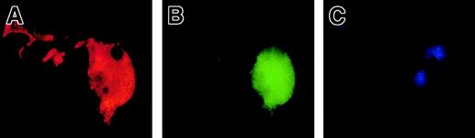 Fig. 6. A cleavage of a caspase-3 substrate (PhiPhiLux) is observed in proplatelet-displaying MKs. / Mobilized blood CD34+ cells were cultured as in Figure 1. A proplatelet-displaying MK at day 12 shows a diffuse staining pattern with PhiPhiLux (A, green fluorescence), predominantly in the perinuclear area. Labeling in the proplatelet is weak. The VWF (red fluorescence) is present in the whole cytoplasm, including proplatelets (B). (C): Nucleus stained with DAPI. Original magnification, × 630.