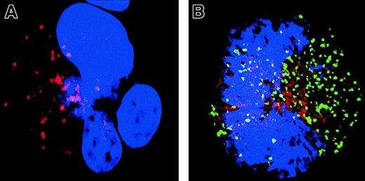 Fig. 8. Localized caspase-3 activation in maturing MKs is associated with a cytosol release of Cyt-c. / A double staining between the anti–caspase-3 Ab (green) and Cyt-c Ab (red) was performed. Cells were counterstained with DAPI and examined by confocal microscopy. An overlay illustration of the labeling is shown. A MK without signs of localized caspase-3 activation (A) has a typical granular labeling with the anti–Cyt-c Ab (red). This pattern of labeling corresponds to labeling in mitochondria when double labeling is performed with an anti–Bcl-2 Ab (data not shown). In contrast, in an MK having granular labeling with the anti–caspase-3 Ab (green; B), labeling with the anti–Cyt-c (red) is weaker and more diffuse, demonstrating signs of MMP in this cell. Original magnification, × 1000.
