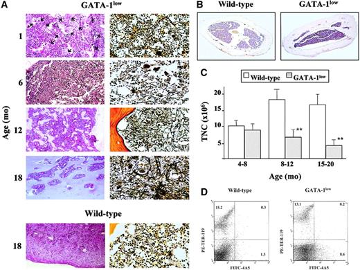 Fig. 2. Development of myelofibrosis in the bone marrow of the GATA-1low mice. / (A) Representative hematoxylin-eosin (left column) and Gomori silver (right column) staining of longitudinal sections of femurs from progressively older (1 to 18 months) GATA-1low mice. Representative stainings of the corresponding sections from an 18-month-old wild-type mouse are also shown for comparison (bottom panels). (Original magnifications: left column, × 20 in all cases, except for the × 40 hematoxylin-eosin staining at 1 month of age as evidence of the massive presence of Mk shown by the arrows; right column, × 40). Similar results were observed in at least 4 mice per age group. In particular, 12 mice were analyzed from the 12- to 18-month-old age group. (B) Hematoxylin-eosin staining of representative transversal sections of femur diaphysis from 18-month-old wild-type (left) and GATA-1low (right) mice (original magnification, × 5). Similar results were observed in at least 3 mice per experimental group. (C) Total number of mononuclear cells (TNC) in the femur of progressively older wild-type (white bars) and GATA-1low (gray bars) mice. Mice were arbitrarily divided into the same age groups used in Tables 2 and 3. Results are presented as the mean (± SD) of 4 to 8 separate determinations per age group, for a total of 12 wild-type and 22 GATA-1low mice analyzed. **P < .01 with respect to the values observed in the age-matched wild-type group. (D) Flow cytometry analysis of the expression of TER-119 and 4A5 in bone marrow cells harvested from wild-type (on the right) and GATA-1low (on the left) animals at 1 month of age. Bone marrow from the GATA-1lowanimals contains approximately 6- to 7-fold more 4A5 cells than the marrow from the wild-type animals.