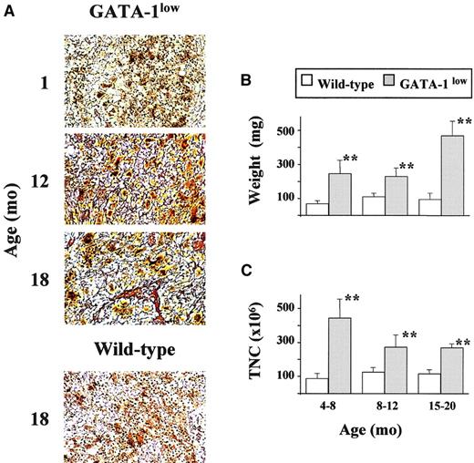 Fig. 3. Development of myelofibrosis in the spleen of GATA-1lowmice. / (A) Gomori reticulum staining of representative spleen sections from GATA-1low mice at 1, 12, and 18 months of age that show the progressive appearance of fibers with age. Corresponding staining of a representative section from one 18-month-old wild-type mouse is also presented for comparison (original magnification, × 20). Similar results were obtained in at least 3 independent experiments per age group. In particular, 12 mice were analyzed for the 12- to 18-month-old age group. (B) Weight (in milligrams) of the spleen from wild-type (white bars) and GATA-1low (gray bars) littermates arbitrarily divided into progressively older age groups (the same as used in Table 2). Results are presented as the mean (± SD) of at least 4 independent determinations per experimental group for a total of 12 wild-type and 18 mutant mice analyzed. **Values in the GATA-1low age groups that are significantly (P < .01) different from those found in normal controls of the same age. (C) Total cellularity (TNC) of the spleen from wild-type (white bars) and GATA-1low (gray bars) littermates arbitrarily divided into progressively older age groups. The same animals as those presented in panel B. See legend to panel B for further details.