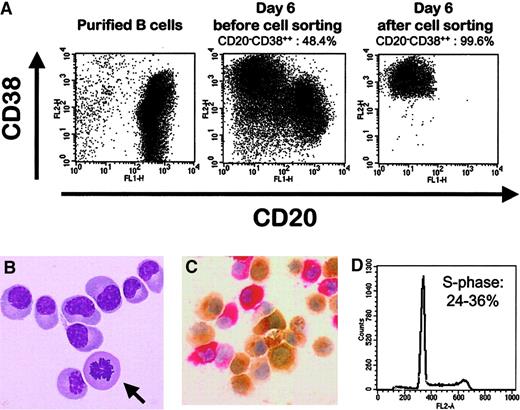 Fig. 1. Differentiation of peripheral blood B cells into polyclonal plasmablastic cells. / (A) Percentages of CD20−/CD38++ cells were evaluated on purified PB B cells, on unseparated cells obtained after the 2-step culture, and on sorted cells. Viable cells were gated by size and granulometry. (B) Giemsa staining of sorted CD20−/CD38++ cells showing their plasma cell morphology and a mitosis figure (arrow). Original magnification, × 1000. (C) Unseparated cells were stained with anti-κ (brown) and anti-λ (red) light chain. Original magnification, × 400. (D) Percentages of CD20−/CD38++ cells in the S-phase were determined using PI staining. They ranged from 24% to 36% in 5 separate experiments.