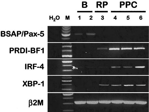 Fig. 4. Expression of the major transcription factors involved in the in vitro differentiation of B cells into plasmablastic cells. / RT-PCR for BSAP/Pax-5, PRDI-BF1, IRF-4, and XBP-1 were performed on purified PB B cells (B, lanes 1 and 2), on purified plasma cells from a patient with reactive plasmacytosis (RP, lane 3), and on CD20−/CD38++ sorted polyclonal plasmablastic cells (PPC, lanes 4-6).