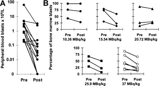 Fig. 5. Antileukemic effects of 213Bi-HuM195. / (A) Numbers of circulating blasts before and after treatment. Fourteen (93%) of 15 evaluable patients had reductions in the number of peripheral blood blasts. (B) Percentages of bone marrow blasts before and after treatment are shown for each dose level from 10.36 to 37 MBq/kg. Fourteen (78%) of the 18 patients had reductions in the percentages of bone marrow leukemia cells after 7 to 10 days.
