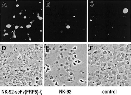 Fig. 5. NK cell–mediated induction of apoptosis in breast carcinoma cells. / SKBR3 cells were incubated for one hour with NK-92-scFv(FRP5)-ζ (A, D) or parental NK-92 cells (B, E) at an E/T ratio of 3:1. Control cells were cultured in the absence of NK cells (C, F). Apoptotic cells were labeled with fluorescein using the TUNEL method and visualized under a fluorescence microscope with blue light excitation. Fluorescent images of representative fields are shown in (A) to (C); phase contrast images of the same sections are shown in (D) to (F).