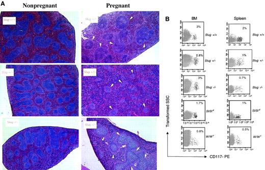 Fig. 3. Erythroid development defects in Slug-deficient mice. / (A) Histologic examination of spleens of nonpregnant mice versus spleens of 12-day pregnant control mice (Slug+/+), Slug heterozygous mice (Slug+/−), and Slug homozygous mice (Slug−/−). Hematoxylin and eosin staining evidenced during pregnancy an enormous increase in the splenic red pulp of Slug+/+ mice in which the splenic white pulp, marked with white arrowheads, was reduced. The increase in the splenic red pulp was less evident in both Slug+/− and Slug−/− mice. (B) Representative analysis of the c-kit+ cells present in the BM and spleen of mice after induction of hemolytic anemia with PHZ. Cells isolated from a wild-type control (Slug+/+), a heterozygous mutant (Slug+/−), a homozygous mutant (Slug−/−), a Steel-Dickie mutant (Sl/Sld), and a W mutant (W/Wv) mouse were stained with the CD117-PE monoclonal antibody and analyzed by flow cytometry. The percentage of c-kit+ cells is indicated. The percentage of c-kit+ cells in spleen and BM before the induction of hemolytic anemia is as follows: 3% in BM and less than 1% in spleen of Slug+/+, Slug+/−, and Slug−/− mice and less than 1% in BM and less than 1% in spleen of W/Wv and Sl/Sld mice. Original magnification × 20.
