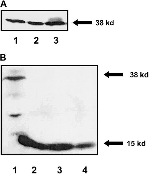 Fig. 1. Expression of SCF isoforms in stromal cell transfectants. / (A) Stromal cells expressing soluble, MA, and MR forms of SCF were lysed and an equal amount of protein was subjected to Western blot analysis using an anti-SCF antibody. A 38-kilodalton (kD) SCF band can be seen in stromal cells expressing the soluble (lane 1), MR (lane 2), and MA (lane 3) forms of SCF. (B) Quantitation of secreted SCF in conditioned medium from stromal cells expressing S-SCF. Lane 1: concentrated conditioned medium from S-SCF–producing stromal cells. Lanes 2, 3, and 4: 6, 3, and 1 ng recombinant E coli–derived SCF (15 kD), respectively. Shown is a Western blot probed with an anti-SCF antibody. Molecular weight of stromal cell secreted soluble SCF (38 kD) and E coli–derived SCF (15 kD) protein is indicated.