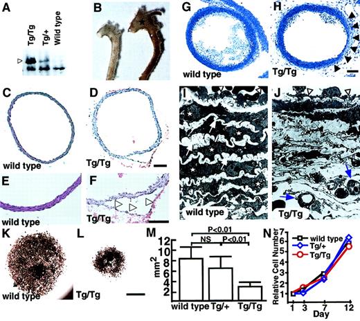 Fig. 4. Abnormal vascular morphology in CAGp-ephrin-B2 Tg mice. / (A) Western blotting of extracts (20 μg protein) from the spleens of neonatal ephrin-B2 Tg mice with anti–ephrin-B2 polyclonal antibody. Arrowhead indicates overexpressed ephrin-B2 protein in CAGp-ephrin-B2 Tg mice. (B) Vascular phenotypes of wild-type (left) and CAGp-ephrin-B2Tg/Tg mice (right) at neonatal stages. The dilated aorta is observed, especially in the ascending portion (stars). (C-F) Cross sections of the ascending aorta stained with hematoxylin and eosin were examined after the aortic dissection event. Tg/Tg mice (D, F) with aortic dissection (arrowheads in F). Bars indicate 100 μm. (G-J) Light and electron micrographs comparing wild-type (G, I) andTg/Tg mouse embryos (H, J) at E19. Sections were stained with toluidine blue. Arrowheads in panel H show a thin vascular wall. Bars indicate 150 μm (G, H). Electron micrographs of the same vessel (G, H) at magnification × 1700 (I, J). In electron micrographs, SMCs (stars) and elastic bands (arrows) have shown the complementary arrangement pattern in wild-type mice (I). In contrast, they have disappeared, and new microvessels (arrows) are observed in this space (J). ECs in Tg/Tg mice have a flat morphology with a budlike structure (arrowheads in J), while ECs in wild-type mice show a round morphology (arrowheads in I). (K-M) Explant culture of ascending aorta from a CAGp-ephrin-B2 Tg/Tg mouse (L) and a wild-type littermate (K) were examined by staining with the anti–smooth muscle actin antibody. Bars indicate 1 mm. (M) Quantitative analysis of the area of smooth muscle actin+ cells was performed with the NIH image computer analyzing system. Each column represents the mean area, and the error bars indicate SD (n = 8). (N) In vitro proliferation analysis. Identical numbers of cells of each genotype were plated. The growth of these cultures was measured by counting the total number of cells on each of the indicated days. A representative experiment is shown. Similar results were obtained from SMCs derived from all 3 genotypes.