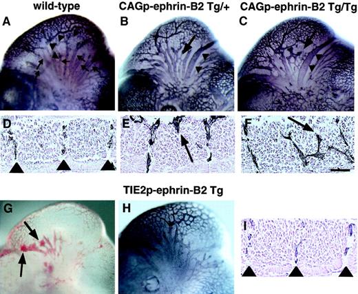 Fig. 5. Aberrant vessel projection in CAGp-ephrin-B2 Tg mice. / Embryonic vasculature in the head region of an E11 wild-type littermate (A), a CAGp-ephrin-B2 Tg/+ embryo (B), a CAGp-ephrin-B2 Tg/Tg embryo (C), and a Tie-2p-ephrin-B2 Tg embryo (H) was visualized by whole-mount immunohistochemistry with the anti–PECAM-1 antibody. (A) Wild-type embryo showing well-developed vascular networks of branches from the ICA (arrowheads) and branches of the ACV (arrows). Note disorganization of the ACV (arrow in B and C) and large-diameter vessels (arrowheads in B and C) in the head of the CAGp-ephrin-B2 Tg mouse. (G) Hemorrhage (arrows) was observed in Tie-2p-ephrin-B2 Tg mice. (H) No disorganization of the ACV and large-diameter vessels in the head of Tie-2p-ephrin-B2 Tg mice. Intersomitic vessels of the trunk at lumbar levels were visualized with the PECAM-1 antibody (D-F, I). A wild-type embryo showing a segmental pattern of intersomitic vessels (arrowheads in D). CAGp-ephrin-B2 Tg mice show the abnormal vessel sprouts penetrating into somites (arrows in E and F), while Tie-2p-ephrin-B2 Tg mice show a normal segmental pattern of intersomitic vessels (arrowheads in I). Top in panels D-F and I is the ventral side. Bars indicate 50 μm.