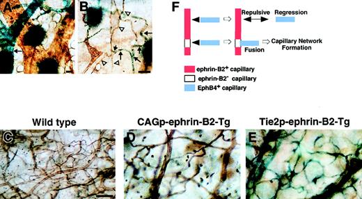 Fig. 6. Defects in capillary formation in both CAGp- and Tie-2p-ephrin-B2 Tg mice. / (A, B) Expression of ephrin-B2 in capillary-sized vessels in the P14 neonatal mouse. Before lectin staining (brown color), X-gal staining was performed. X-gal staining of ephrin-B2LacZ/+ mice indicates that ephrin-B2 (blue color) was detected sporadically in capillary-sized vessels (arrows in B), while ephrin-B2 was strongly expressed in the large-sized arterial vessels (arrows in A). Arrowheads in panel B indicate ephrin-B2− ECs in capillary-sized vessels. Comparison of microvessel morphology of the ear in lectin-stained whole mounts of ear skin (C-E). A marked decrease in capillary-sized vessels was seen in CAGp-ephrin-B2 Tg mice and Tie-2p-ephrin-B2 Tg mice compared to wild-type littermates. X-gal staining indicates that ephrin-B2 (blue color) was expressed in arteries, veins, and capillary-sized vessels in Tie-2p-ephrin-B2 Tg mice (E). A model of capillary formation is shown in panel F. All bars indicate 50 μm. In lines 12 and 21, the total numbers of surviving mice were counted from 3 independent crosses between F1 Tg/+ male and Tg/+ female mice.