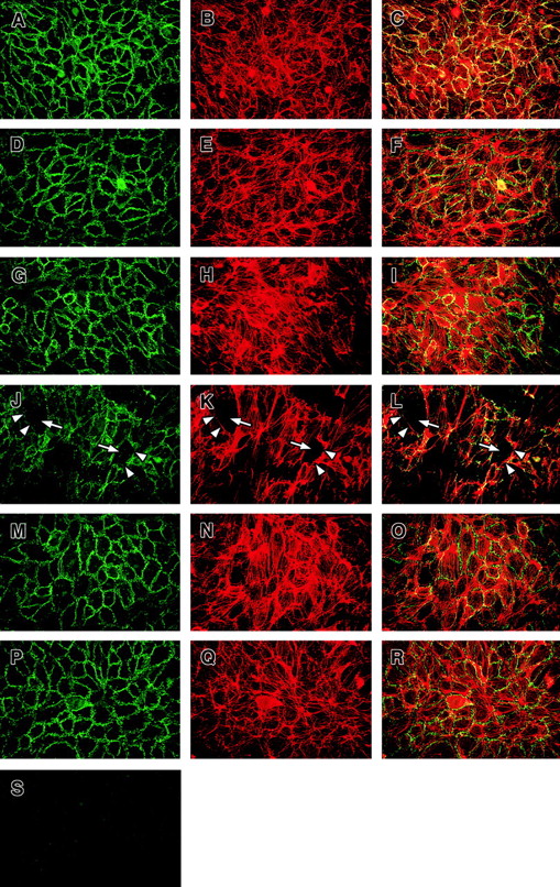 Fig. 7. Effect of factor VIII–deficient plasma on VE-cadherin distribution on ECs. / HUVECs were grown on fibronectin-coated glass cover slides, stained for VE-cadherin and F-actin, and visualized by double immunofluorescence (original magnification × 40) as described in “Materials and methods.” Overlays show F-actin in red and VE-cadherin in green; colocalization appears in yellow. (A-C) Staining for VE-cadherin and F-actin in untreated cells. VE-cadherin and F-actin staining of ECs exposed to factor VIII–deficient plasma without TNF (D-F), TNF alone (G-I), factor VIII–deficient plasma on ECs pretreated with TNF (J-L), factor VIII–deficient plasma pretreated with TNF in the presence of AT III (M-O), and AT III alone (P-R). Slides from a 90-minute time point are shown. Note the gaps between the adjacent ECs (white arrows) and the lack of VE-cadherin (white arrowheads) only on ECs exposed to factor VIII–deficient plasma pretreated with TNF (J-L). Preabsorbtion of anti–VE-cadherin antibody with an appropriate peptide abolished the VE-cadherin staining (S).