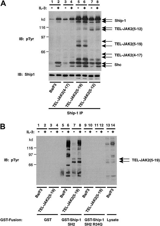Fig. 2. TEL-JAK2 expression results in constitutive tyrosine phosphorylation of Ship-1 and association with the SH2 domain of Ship-1. / (A) Ba/F3 and Ba/F3-TEL-JAK2 cells lines were depleted of cytokine and then stimulated in the presence (+) or absence (−) of IL-3. IPs were performed using a Ship-1 antibody, and tyrosine-phosphorylated proteins were detected by pTyr IB (upper panel). Total Ship-1 was detected by reprobing with a Ship-1 antibody (lower panel). (B) Ba/F3 and Ba/F3-TEL-JAK2(5-19) cells were depleted of cytokine and then stimulated in the presence (+) or absence (−) of IL-3. GST in vitro mixes were performed using 5 μg GST (lanes 1-4), GST–Ship-1 SH2 domain (lanes 5-8), or GST–Ship-1 Arg34Gln (lanes 9-12). Ba/F3 lysates are shown (lanes 13, 14). Tyrosine-phosphorylated proteins were detected by IB with a pTyr antibody.