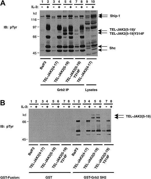 Fig. 9. TEL-JAK2(5-19)Tyr314 represents a major binding site for Grb2. / (A) Ba/F3 cells, Ba/F3-TEL-JAK2(4-17), TEL-JAK2(5-19), and TEL-JAK2(5-19)Tyr314Phe cells were depleted of cytokine and then stimulated in the presence (+) or absence (−) of IL-3. IPs were performed using a Grb2 antibody, and tyrosine-phosphorylated proteins were detected by pTyr IB (upper panel). (B) Ba/F3, TEL-JAK2(4-17), TEL-JAK2(5-19), and TEL-JAK2(5-19)Tyr314Phe cells were depleted of cytokine and stimulated with (+) or without (−) IL-3. GST in vitro mixes were performed with 5 μg GST (lanes 1-8) or GST fused to the SH2 domain of Grb2 (lanes 9-16). Tyrosine phosphorylation was assayed by IB with pTyr antibody.