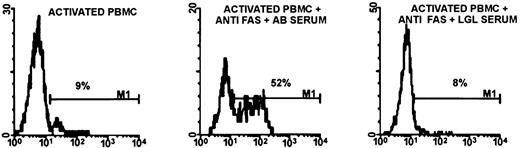 Fig. 5. LGL serum blocks Fas-induced apoptosis of normal activated T cells. / Panel on left shows spontaneous apoptosis. Panel in middle shows apoptosis of normal activated cells induced by anti-Fas mAb, with normal human serum added. Panel on right shows blocking of apoptosis by serum from an LGL leukemia patient. Similar results were obtained when studying sera from an additional 7 patients with LGL leukemia.