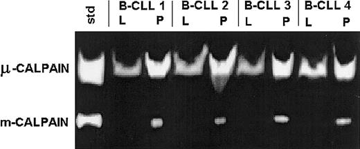 Fig. 2. B-CLL cells express the activities of both μ- and m-calpain. / Lysates of B-CLL cells of 4 patients (B-CLL 1 through 4) were prepared in either lysis buffer (L) or PBS (P) as in “Patients, materials, and methods” and tested by casein zymography. A mixture of 0.1 μg each of commercial μ- and m-calpain was processed alongside and served as activity standard (std). The activity of m-calpain can only be seen in the lysates prepared in PBS in which the activity of μ-calpain also is relatively enhanced.