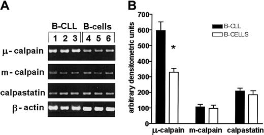 Fig. 7. The expression of gene for μ-calpain, but not that of m-calpain and calpastatin, is significantly increased at the transcriptional level compared with healthy B cells. / (A) Representative results of an RT-PCR estimation of the activities of μ-, m-calpain, and calpastatin genes in 3 B-CLL samples and 3 samples of enriched B cells of healthy, age-matched individuals. The β-actin gene product was used to assure that an equal amount of total mRNA was analyzed. (B) Mean results of 3 experiments similar to those shown in panel A. The difference (Student t test) between the amounts of gene product for μ-calpain was statistically significant at the level of P < .01 (*).