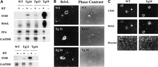 Fig. 1. BclxL transgene expression in megakaryocytes. / (A) PCR-based cDNA amplification, showing transgene expression in BM of transgenic mice, as described in “Materials and methods.” Reverse-transcribed, amplified DNA was electrophoresed, transferred onto a nylon membrane, and analyzed with 32P-labeled probes as indicated. The reaction was carried out in the absence or presence of reverse transcriptase (RT) for transgenic lines (Tg) and wild-type (WT) mice. SV40 probe detects the transgene only, BclxL probe detects the endogenous and transgenic BclxL at similar positions, and both PF4 and GAPDH are used to evaluate and normalize for the efficiency of the RT reaction. The lower panel with SV40 probe shows twice the time of the exposure of the film as the top panel to permit visualization of the band in Tg12. Data are representative of 3 experiments. (B) BM cells derived from transgenic (Tg) or control (WT) mice were cytospun (as a dense layer of cells to allow focus on the rare megakaryocytes) and Cy3-labeled with rabbit antibodies to human BclxL (which also reacts with mouse BclxL). Transgenic megakaryocytes, identified based on size and morphology, displayed higher levels of BclxL, as compared with control (examinations were done blindly). The staining appeared cytosolic, as also described by others.42 The data are representative of 2 transgenic lines (2 mice per line in duplicates; original magnification, × 400). (C) Freshly derived BM cells were cytospun onto a slide and subjected to immunohistochemistry with anti-BclxL (middle panel). Megakaryocytes were identified based on staining with an antibody to CD41 (top panel) and DNA was stained with Hoechst (lower panel). No staining was observed with secondary antibody alone and no BclxL-specific fluorescence was observed on staining with CD41 alone and vice versa (not shown). The micrographs are of a representative field, further demonstrating enhanced, lineage-specific expression of BclxL in a transgenic line (original magnification, × 400).