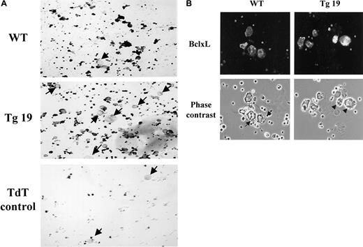Fig. 2. A decrease in the number of megakaryocytes undergoing apoptosis is detected in BclxL transgenic mice. / BM cultures of transgenic line 19 (Tg19) or control (WT) mice were enriched for megakaryocytes by indirect immunomagnetic negative separation. Following this procedure, there are still numerous, contaminating BM cells. (A) Apoptotic cells were detected by dark staining with the ApopTag Plus Peroxidase in situ Apoptosis Detection kit. Arrows point to some of the nonapoptotic megakaryocytes (original magnification, × 200). The experiment shown is representative of 3 performed. Terminal dioxyl transferase (TdT) enzyme control was always included in the study, because contaminant magnetic beads often give a positive signal. (B) Isolated megakaryocytes were cytospun and stained with Cy3-labeled rabbit antibodies to human BclxL (which also reacts with mouse BclxL; original magnification, × 400). In the center of the WT panel are proplatelet-forming cells with poor BclxL expression. The arrows point to cellular extensions (as also demonstrated in detail in Figure 7), which do not appear in megakaryocytes with high abundance of BclxL (eg, Tg19; indicated by arrowheads).