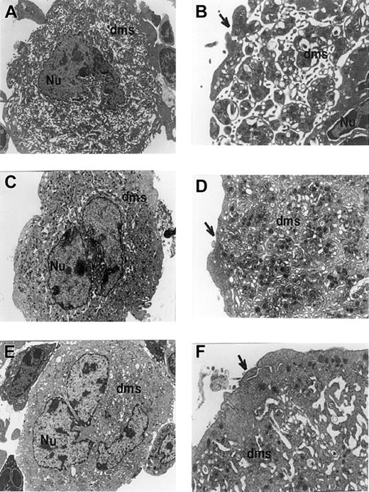 Fig. 5. Transmission electron micrographs of megakaryocytes derived from control or BclxL transgenic mice. / Micrographs show megakaryocytes from WT control (A,B), Tg19 (C,D), and Tg16 (E,F) mice. At least 50 megakaryocytes from 3 different mice (control and transgenic) were analyzed. The nucleus (Nu) and demarcation membrane system (dms) are labeled. Note the poor dilation of demarcation membranes in panels C through F. Arrows point to peripheral sheet of cytoplasm which appearance is consistent with platelet shedding in control cells (A,B). Note the extensive outer ring of cytoplasm in panels C and D, and especially in panels E and F. Granule numbers are comparable in control and transgenic megakaryocytes. Original magnifications, × 4500 in panels A, C, and E; × 12 500 in panels B, D, and F.