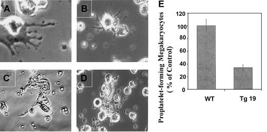 Fig. 7. The frequency of megakaryocytes capable of forming proplatelets is decreased in BM cultures derived from BclxL transgenic mice. / BM cultures of Tg19 or WT mice were enriched for megakaryocytes by indirect immunomagnetic negative separation. Isolated megakaryocytes were cultured for 3 days as described in “Materials and methods” and subjected to examination by phase contrast microscopy (A-D). Note 3 different types of cytoplasmic extensions for WT megakaryocytes: beaded proplatelets (A), pseudopodialike (B), and long, thin extensions (C), whereas mainly one type was observed for Tg19—long, thin extensions (D). Original magnification, × 600 for panel A and × 400 for panels B, C, and D. (E).The frequency of megakaryocytes making proplatelets was monitored. The data are averages ± SD for 3 experiments, with 2 wells analyzed in each.