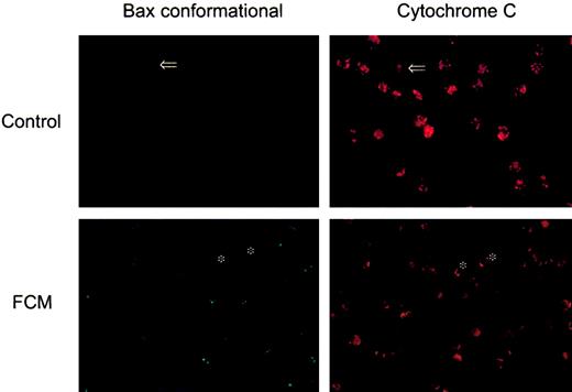 Fig. 4. Cellular localization of Bax and cytochrome c during drug-induced apoptosis. / Cells from a representative patient were incubated in the absence or presence of the FCM combination for 24 hours. Cells were immunostained with anti-Bax (clone YHT-6A7, green fluorescence) and anti–cytochrome c (red fluorescence). Photographs of the same fields were obtained with optical filters specific for green and red light (original magnifications, × 600). Arrows indicate the same apoptotic cell showing a punctuated Bax staining and having lost cytochrome c. Asterisks on the lower panel indicate viable cells (negative staining for Bax and bright punctuated signal for cytochrome c).